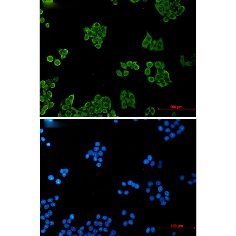 CSDE1 Rabbit mAb